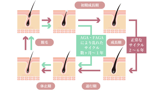 AGA・FAGAとは