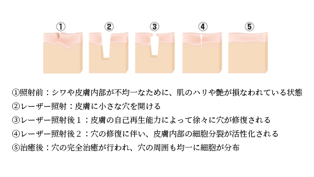 ブリッジセラピーの肌再生のしくみ