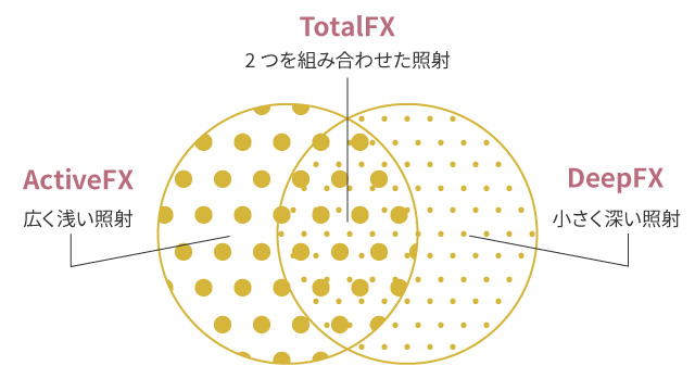 お悩みに合わせた3種類の照射方法