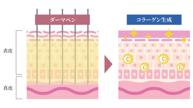 肌を再生させ深層から整える