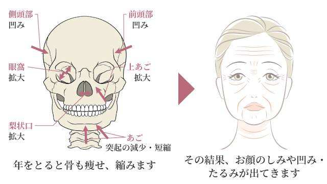 しわ・たるみのメカニズム