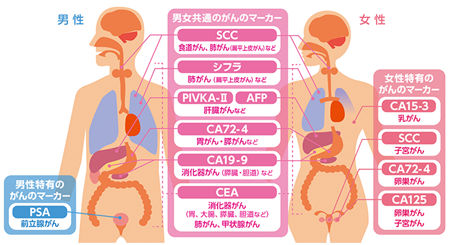 オプション検査