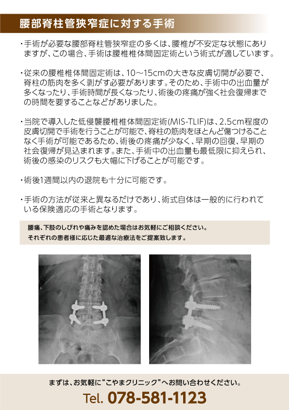 低侵襲手術